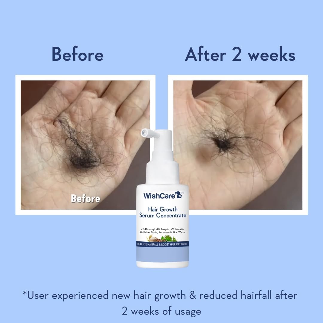 WishCare Hair Growth Serum with Rosemary, Redensyl, Anagain, Baicapil, Caffeine, Biotin