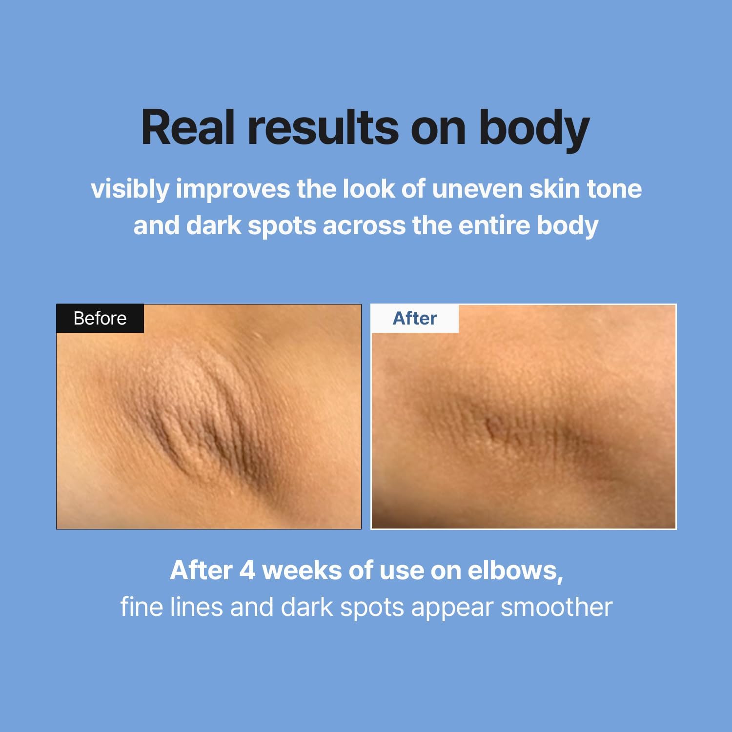 MEDITHERAPY Retinal Skin Booster Serum – Beginner-Friendly, Non-Irritating Retinol for Face and Body – Pore Minimizer, Wrinkle Treatment, Glass Skin – Korean Skin Care, 150ml Large Size