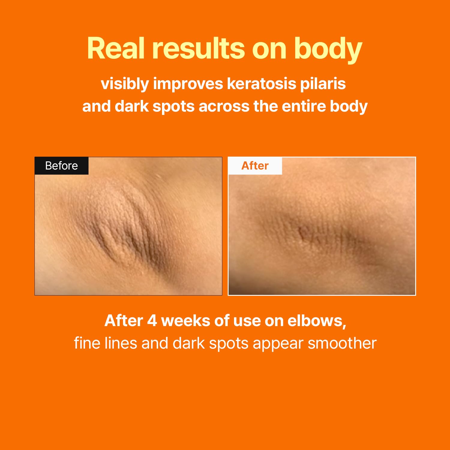 MEDITHERAPY Retinal Skin Booster Serum | Retinaldehyde, Niacinamide Anti-Aging Serum - K-Beauty Facial Serum for Fine Lines, Firming & Radiance | Hydrating Face Serum All Skin Types, 5.07 fl oz Halalzen
