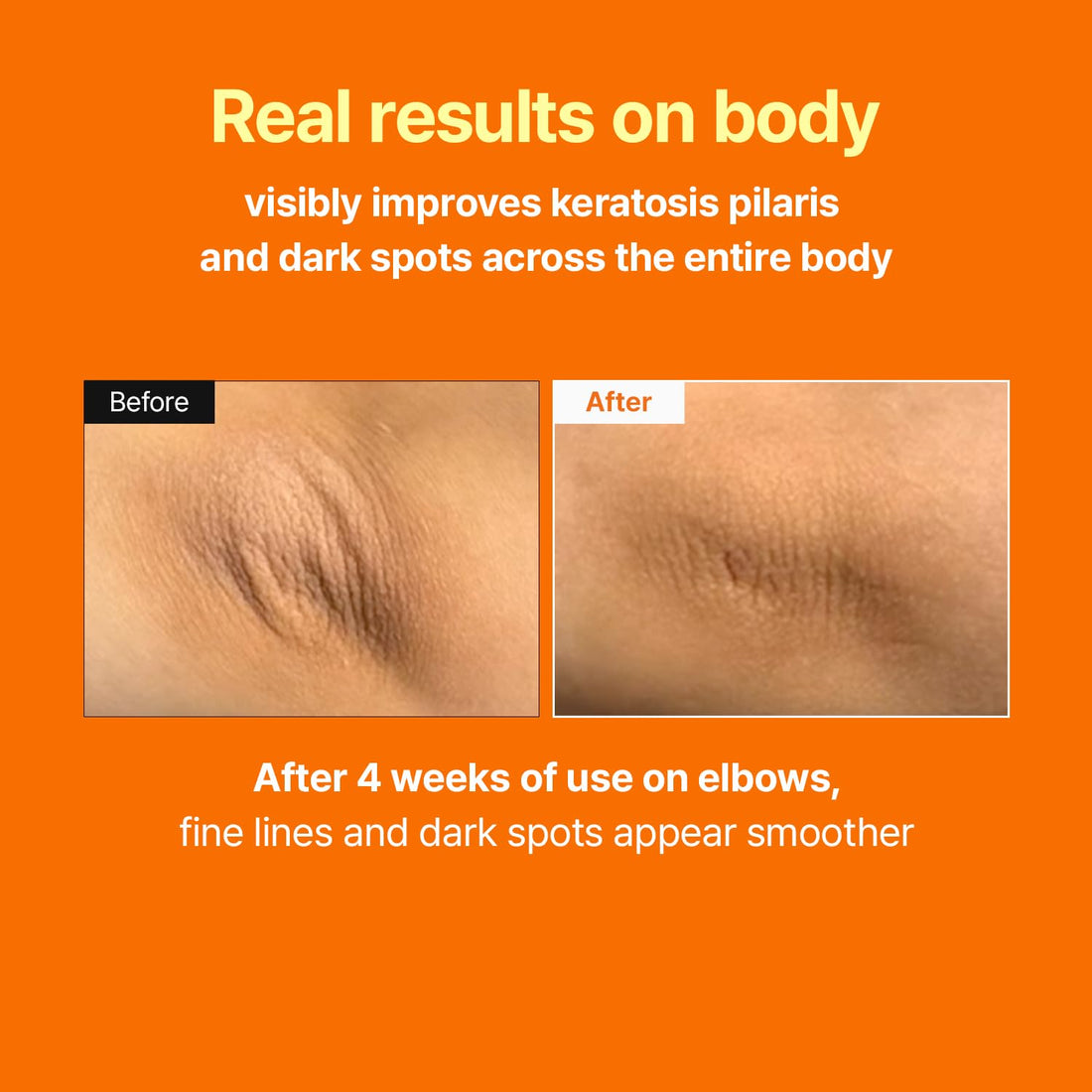 MEDITHERAPY Retinal Skin Booster Serum | Retinaldehyde, Niacinamide Anti-Aging Serum - K-Beauty Facial Serum for Fine Lines, Firming & Radiance | Hydrating Face Serum All Skin Types, 5.07 fl oz Halalzen