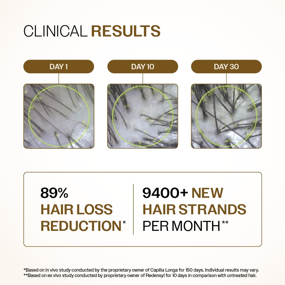 Bare Anatomy Advanced Hair Growth Serum| 3% Redensyl - 2x Better Results than Minoxidil | + 4% Anagain + 3% Baicapil | Rosemary, Biotin | Hair growth & Hair fall control serum for Women & Men | 30mL