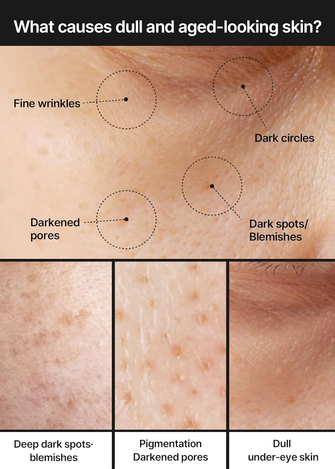 celimax Pore Dark Spot Brightening Cream With Niacinamide, Tranexamic Acid, Txa Cream, Pore Minimizer, Non-Irritating, Hydrating, For Sensitive Skin, 35Ml
