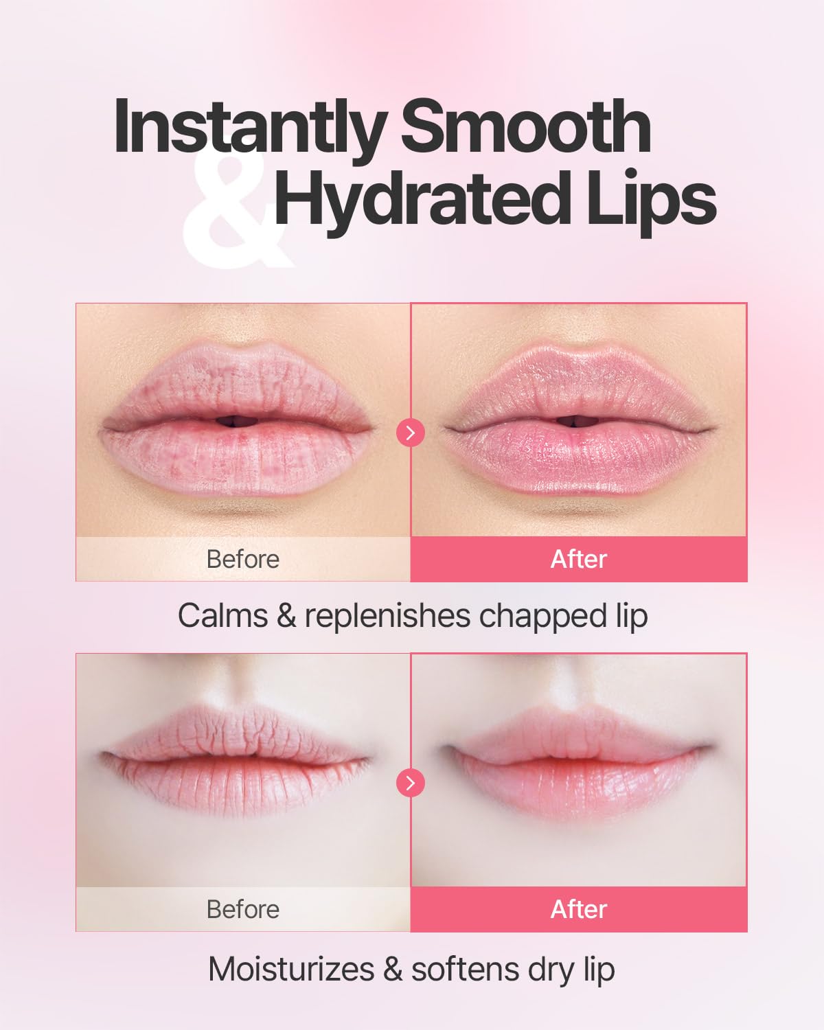 Aura Quartz Hydrogel Lip Mask 5ea - Moisturizing Lip Mask with Retinol, Peptide, Collagen, PDRN, Bakuchiol, Anti-aging Lip Care for Dry Lips, Reduces Laugh Lines, Smooth and Plump Lips Halalzen