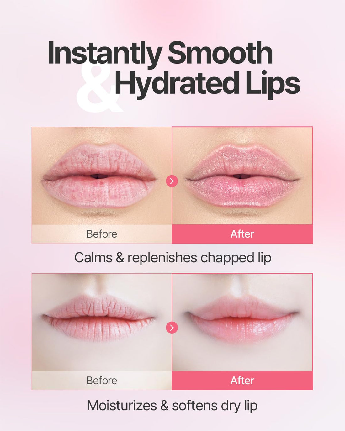 Aura Quartz Hydrogel Lip Mask 5ea - Moisturizing Lip Mask with Retinol, Peptide, Collagen, PDRN, Bakuchiol, Anti-aging Lip Care for Dry Lips, Reduces Laugh Lines, Smooth and Plump Lips Halalzen