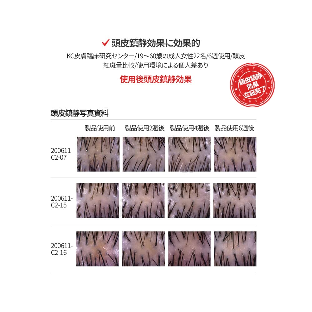 TS Gold Plus Shampoo | Hair Loss Shampoo with Biotin, Gold Extract & Niacinamide | Scalp Circulation & Volume Care | Sulfate-Free Korean Hair Care for Thinning Hair (17.6 Fl Oz / 500mL) Halalzen