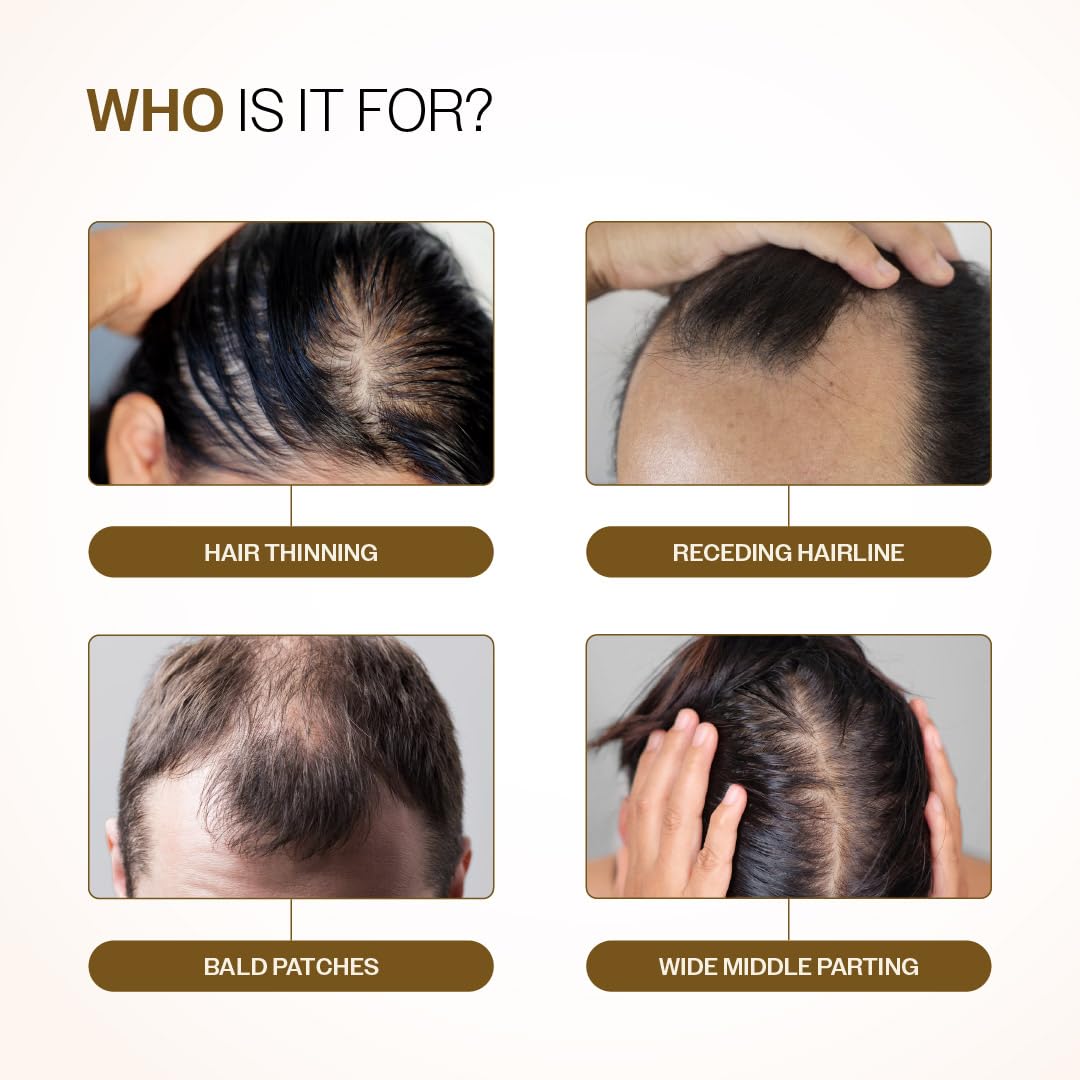 Bare Anatomy Advanced Hair Growth Serum| 3% Redensyl - 2x Better Results than Minoxidil | + 4% Anagain + 3% Baicapil | Rosemary, Biotin | Hair growth & Hair fall control serum for Women & Men | 30mL