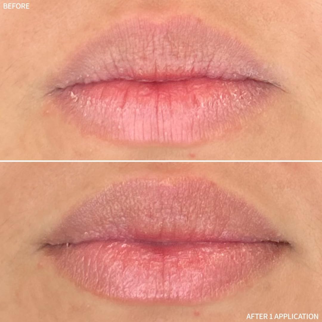 RescueMD Restorative Lip Treatment, Peptide-Powered Rejuvenation + Arnica Repair for Healthy, Hydrated Lips (12mL) Halalzen