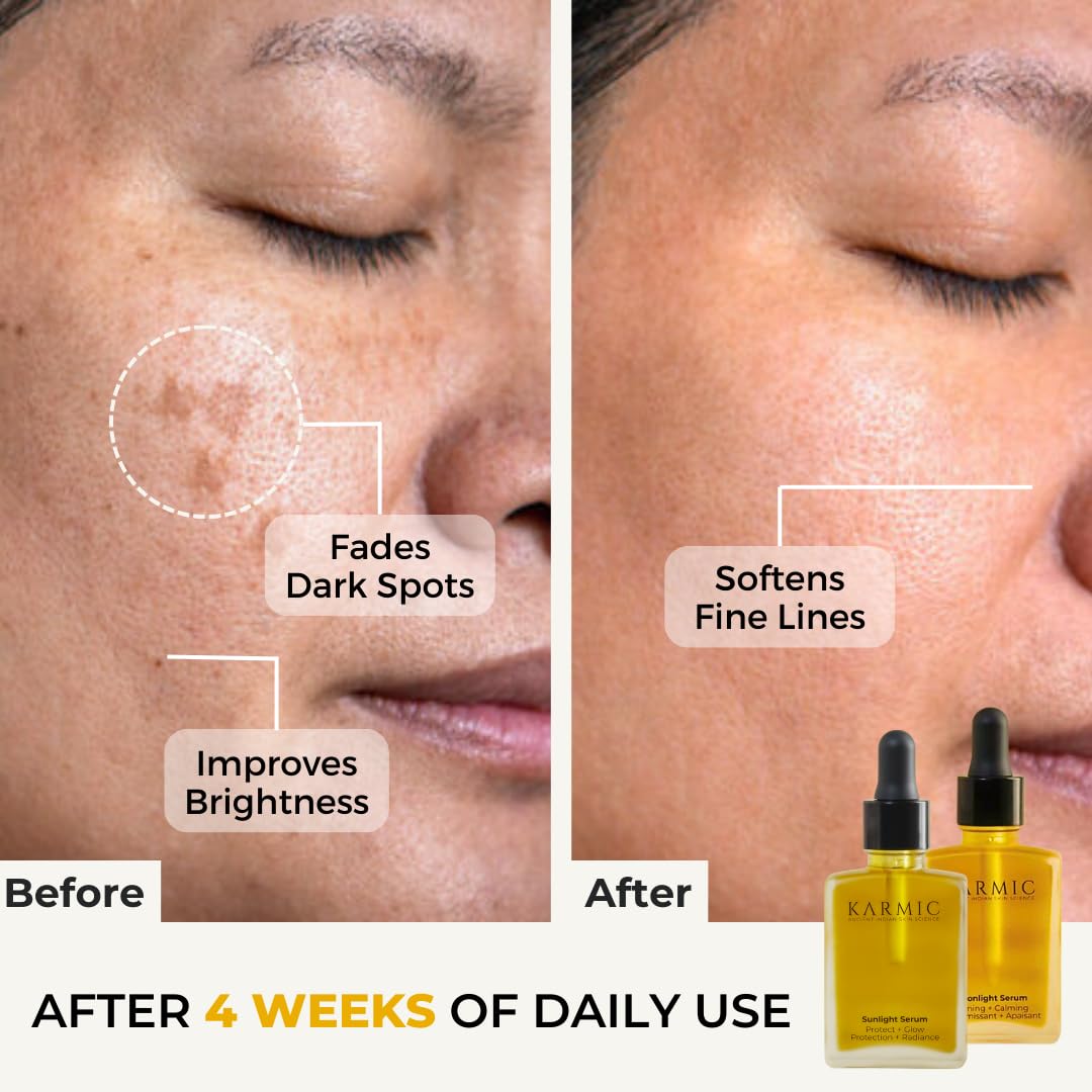 Karmic Skin Brightening Vitamin C Face Serum: With Saffron & Vit. E | Hydrate & Reveal Bright Glowing Skin | Correct Dark Spots | Treat Hyperpigmentation | Organic Facial Oil Skin Care | Women & Men