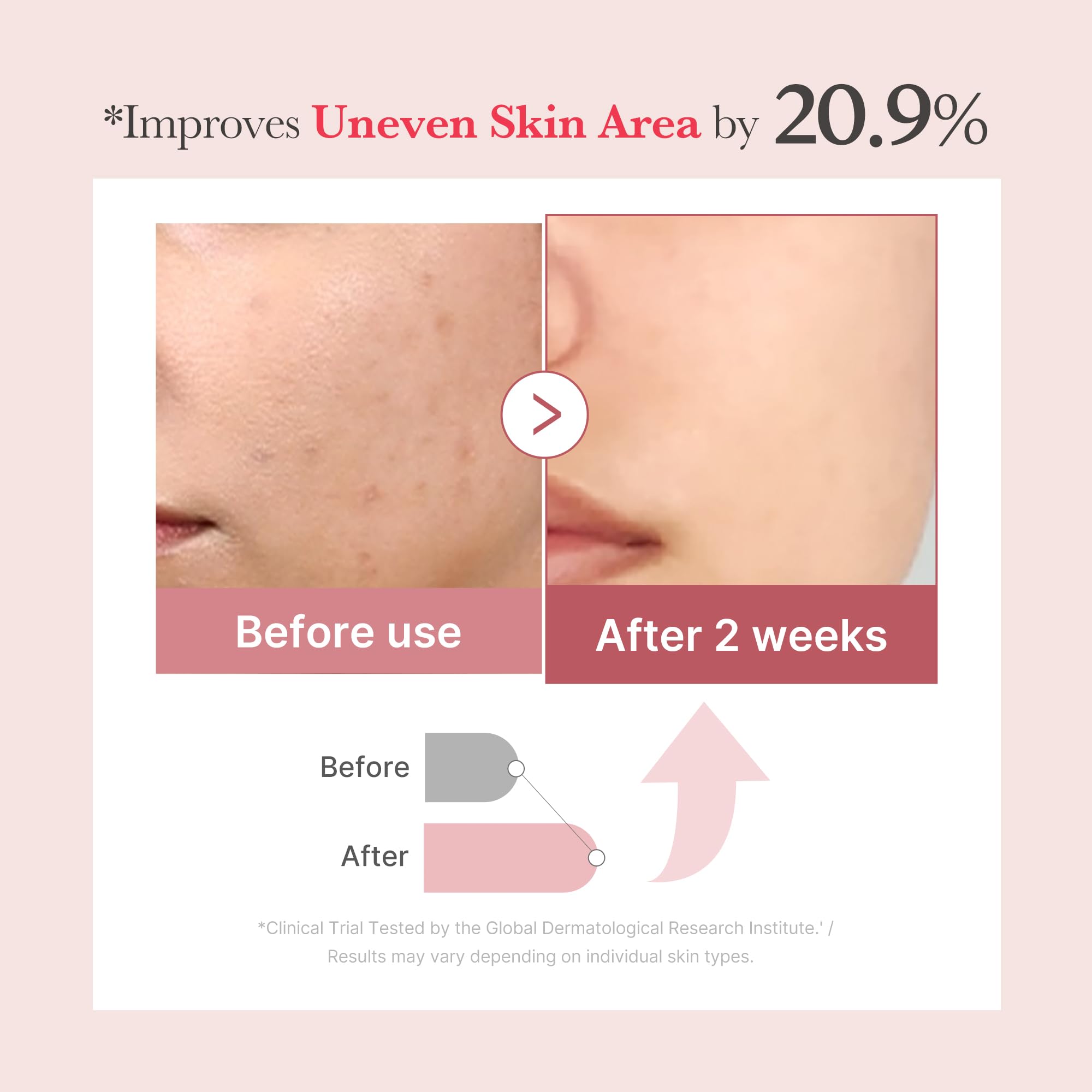 medicube Exosome Shot Zero 2,000 PPM Spicule Facial Serum | Liquid Skin Booster Serum | Exosome, AHA+BHA+PHA | Pore Care, Dead Skin Cells, Skin Texture | Korean Skincare, 1.01 fl.oz Halalzen