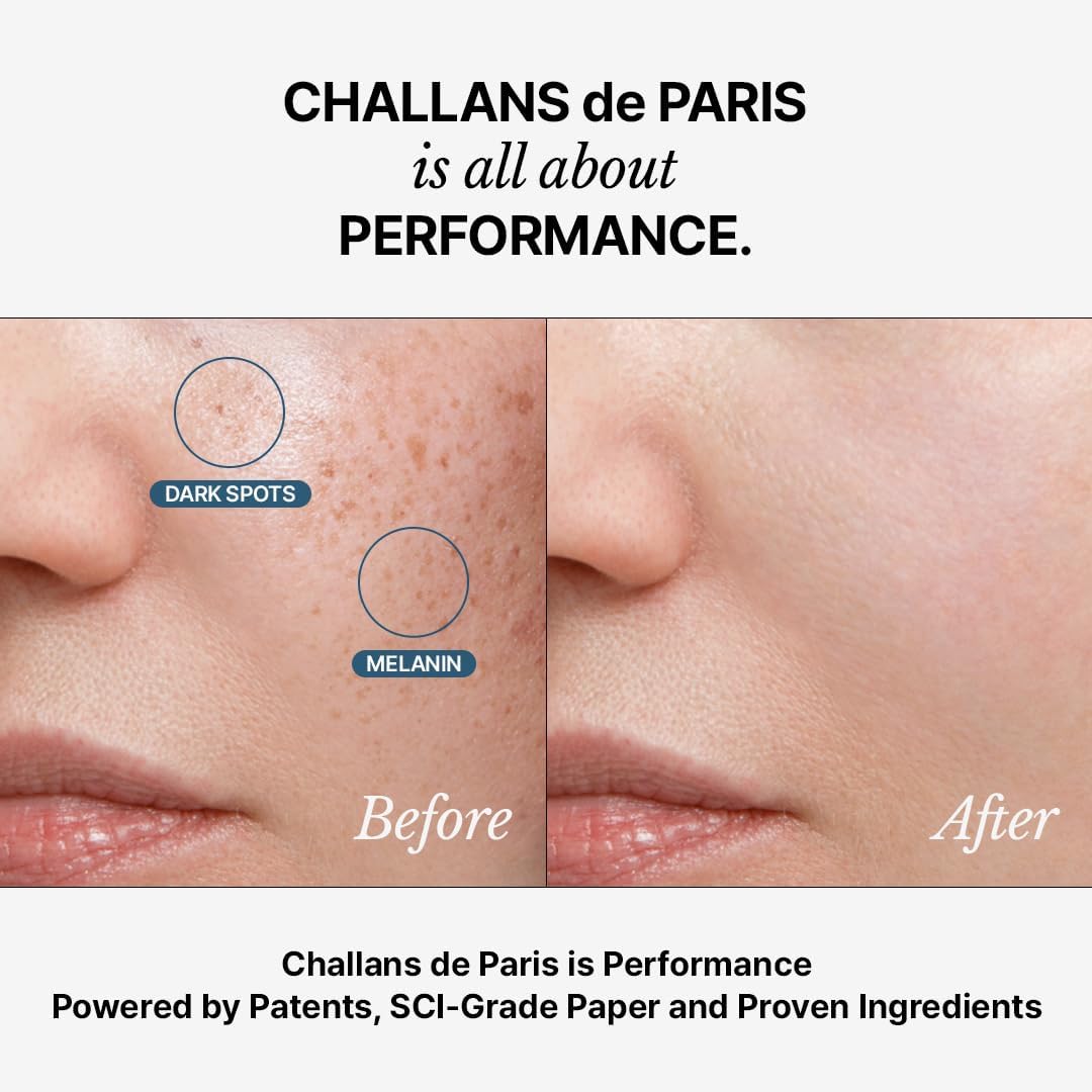 [CHALLANS de PARIS] Ampoule de Albarosa Dark Spot Care Serum – Sun Damage Repair, Brightening & Hydration, Face Ampoule for Even Skin Tone, Lightweight Korean Skincare, 35 ML