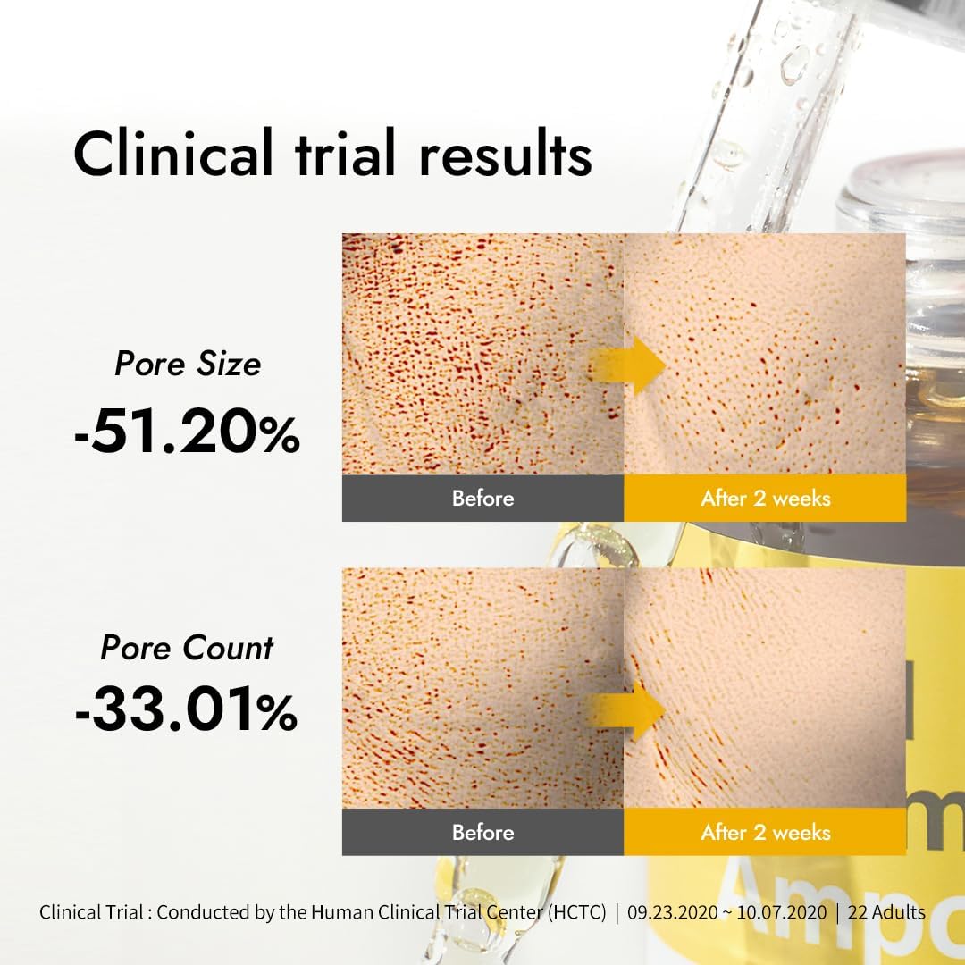 [MIZON] REAL VITAMIN C AMPOULE (30ml) Korean Skincare - Brightening Serum with Pure Vitamin C (19%) No water added - Tone Correction - Nourishing & Hydrating - Natural Ingredients