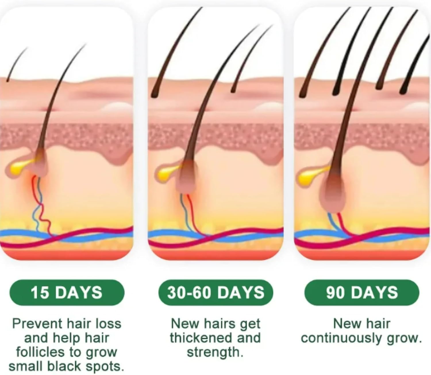 Alopecia Ha-ir Growth Cream,H-air Los/s Treatment for Women,H-air Loss Treatment for Men,Rogaine H-air Regrowth Men，Scalp Nourishing Anti Hair Loss Serum,Hair Thinning,Scalp Moisturizer，20g