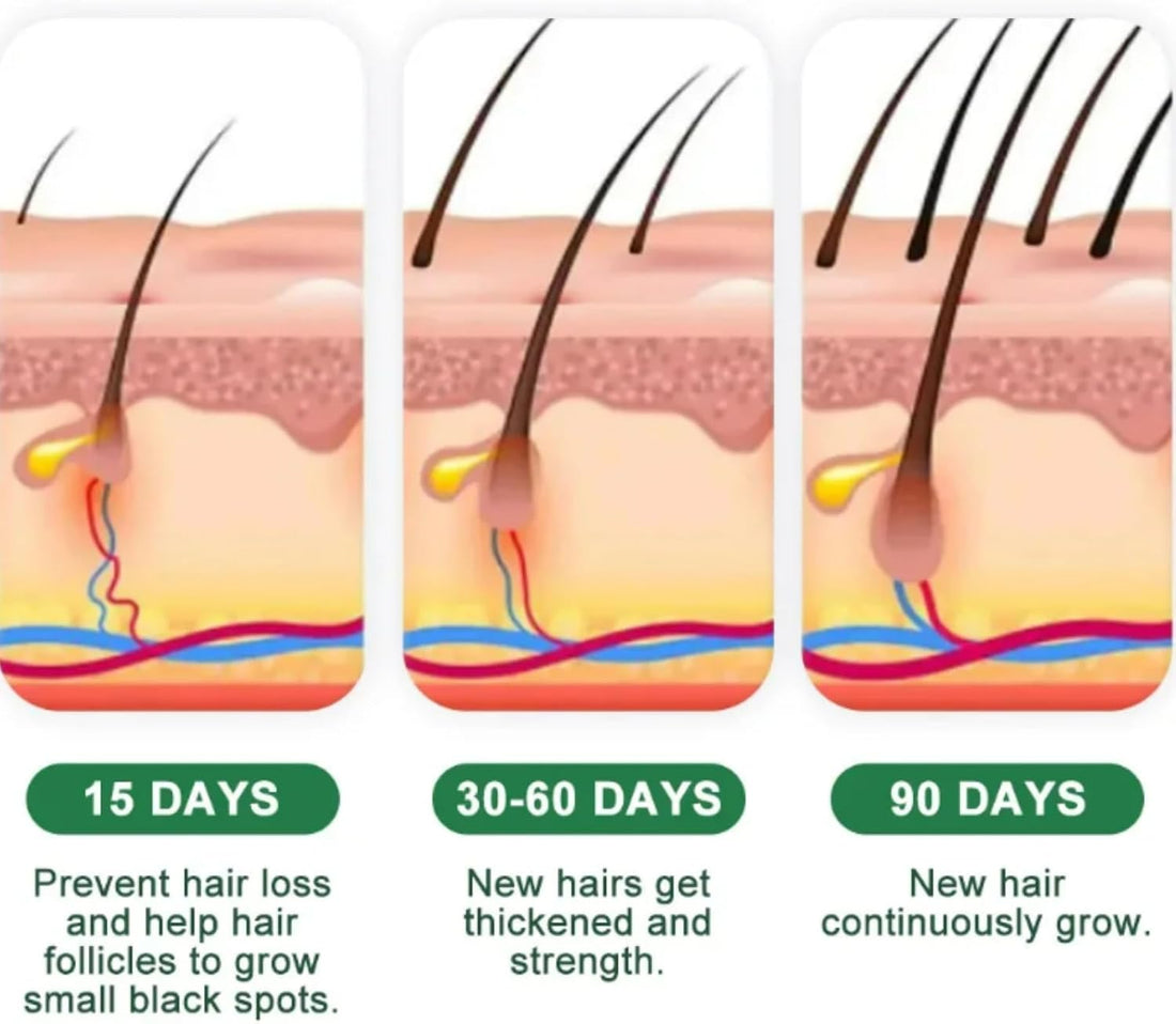 Alopecia Ha-ir Growth Cream,H-air Los/s Treatment for Women,H-air Loss Treatment for Men,Rogaine H-air Regrowth Men，Scalp Nourishing Anti Hair Loss Serum,Hair Thinning,Scalp Moisturizer，20g