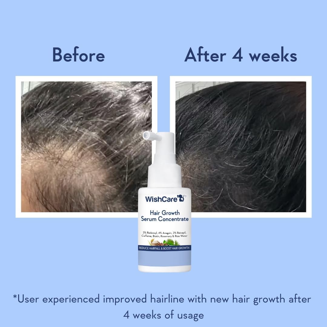 WishCare Hair Growth Serum with Rosemary, Redensyl, Anagain, Baicapil, Caffeine, Biotin