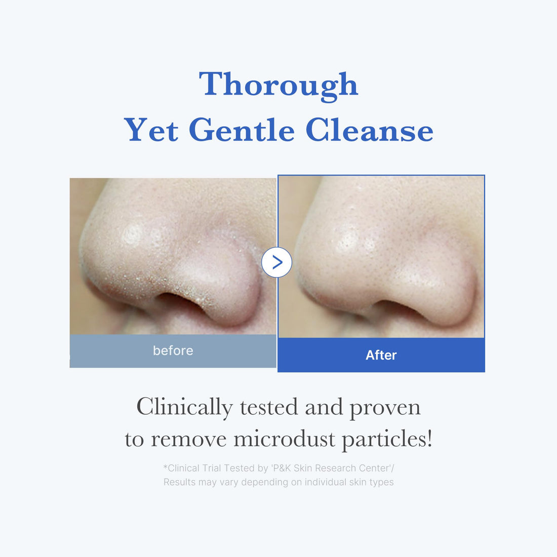 medicube Zero Foam Cleanser for Sensitive Skin - Sebum Control, Moisture Balance, and Pore Minimization | Korean Skincare 120g