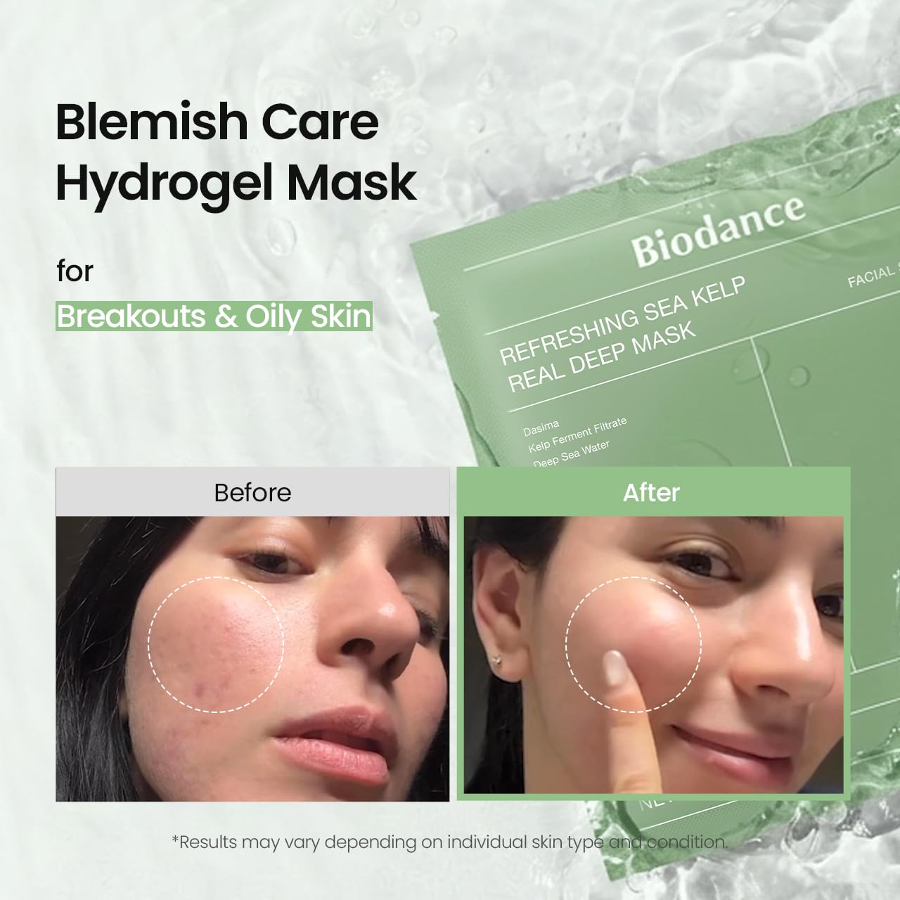 BIODANCE Hydro Cera-nol Real Deep Mask, Hydrating Overnight Hydrogel Face Mask, Moisturizing, Redness Reducing, Quick Soothing, After Sun Care, Sunburn Relief, Korean Skin Care |1.19oz(34g) x4ea Halalzen