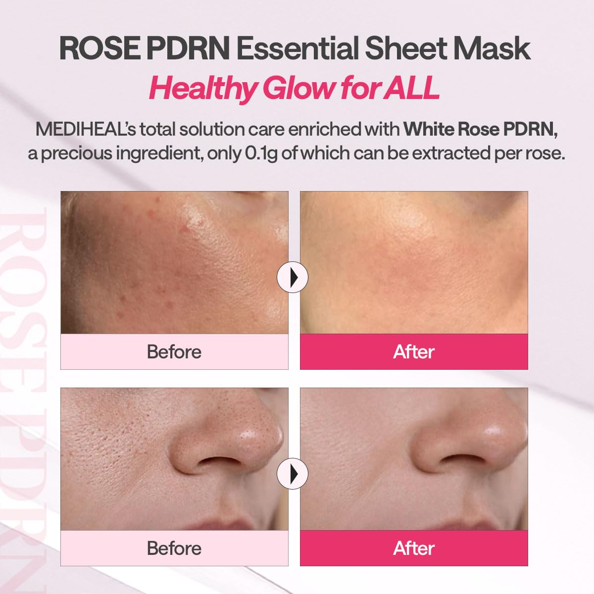 Mediheal Essential Face Mask [Skin Firming] 10 pcs. for Plumping Hydration, Glass Skin & Skin Nourishment - Travel Essentials, Korean Beauty Sheet Mask Halalzen
