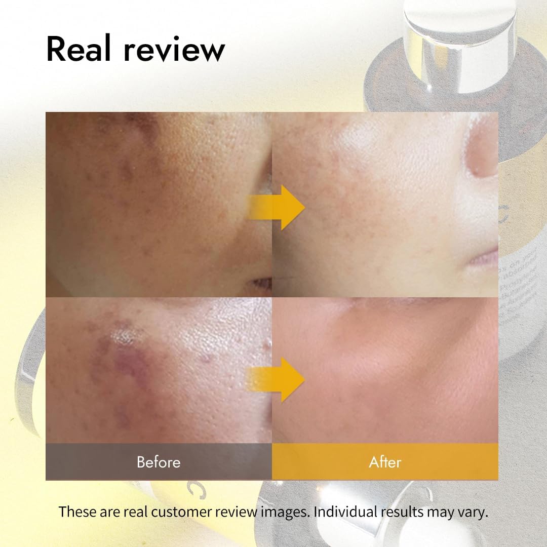 [MIZON] REAL VITAMIN C AMPOULE (30ml) Korean Skincare - Brightening Serum with Pure Vitamin C (19%) No water added - Tone Correction - Nourishing & Hydrating - Natural Ingredients