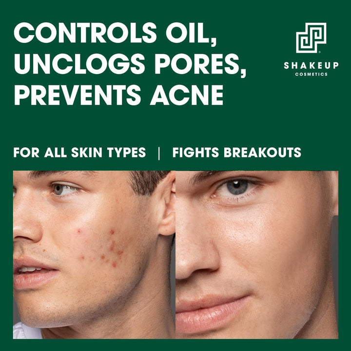 Shakeup Cosmetics Mens Skin Clearing Toner, Clarifying, Gently Exfoliates with Glycolic Acid & Witch Hazel, Reduces Oil & Shine, Vegan Formula, 200ml. Aka. FACE 4WARD CLARIFYING Toner Halalzen