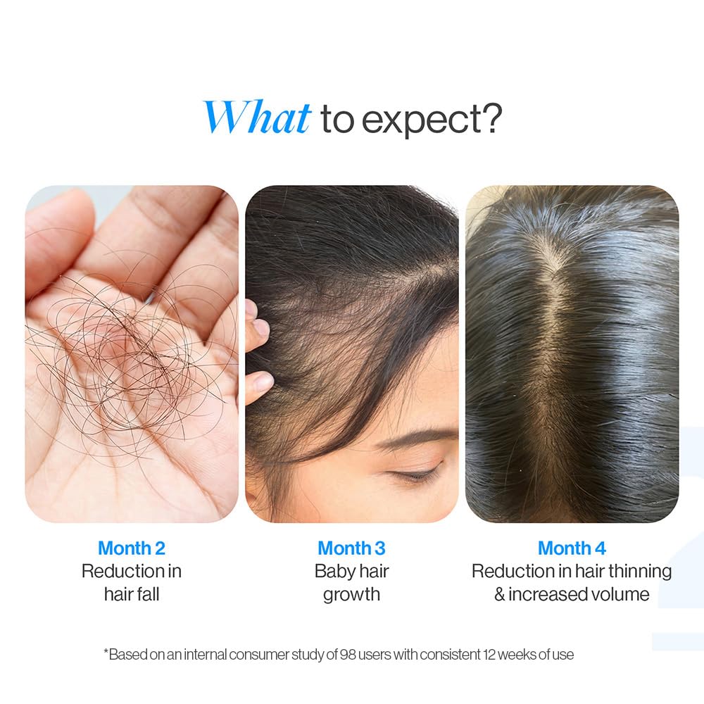 Be Bodywise Rosemary Hair Growth Serum (Roll On) | 3% Redensyl & 2% Anagain | Hair fall control serum for Women & Men | Promotes Hair Growth & Stimulates Hair Follicles | For All Hair Types | 25ml