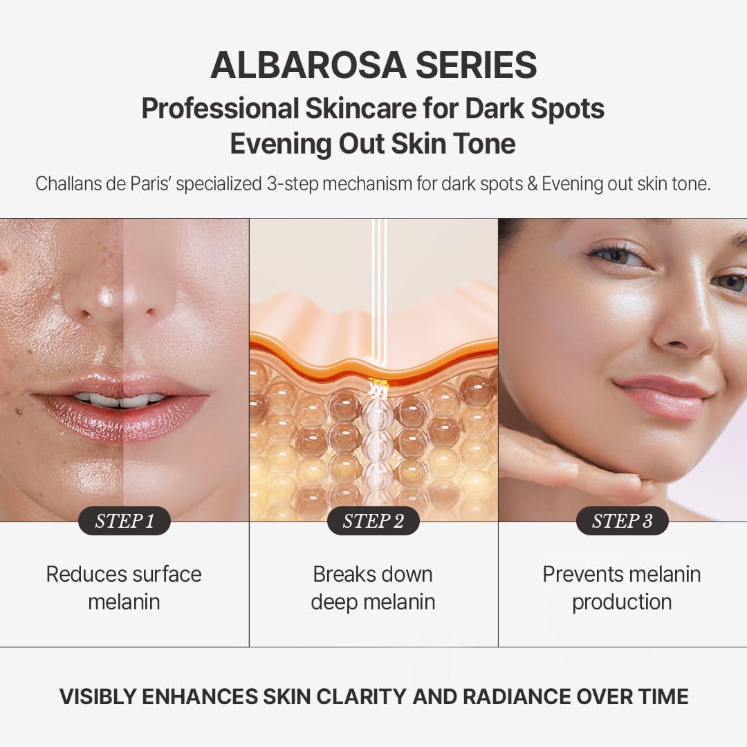 [CHALLANS de PARIS] Ampoule de Albarosa Dark Spot Care Serum – Sun Damage Repair, Brightening & Hydration, Face Ampoule for Even Skin Tone, Lightweight Korean Skincare, 35 ML