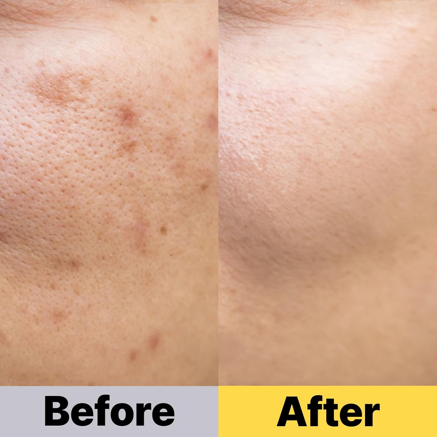 COSNOLOGY K-Beauty Ampoule: Niacinamide + Vitamin C, E & Glutathione for Dark Spots & Even Skin Tone | Hydrating & Anti-Aging, 2.7fl.oz(80ml) Halalzen