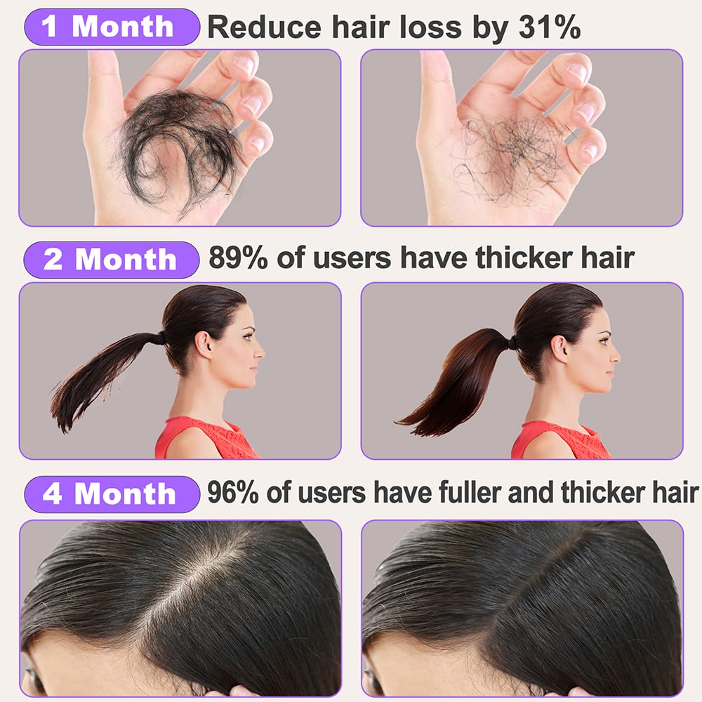Rosemary Oil for Hair Growth,2x120ml Diluted Rosemary Oil and Hair Serum for Dry Damaged Hair,Proven Hair Loss Treatment & Hair Thickening Products