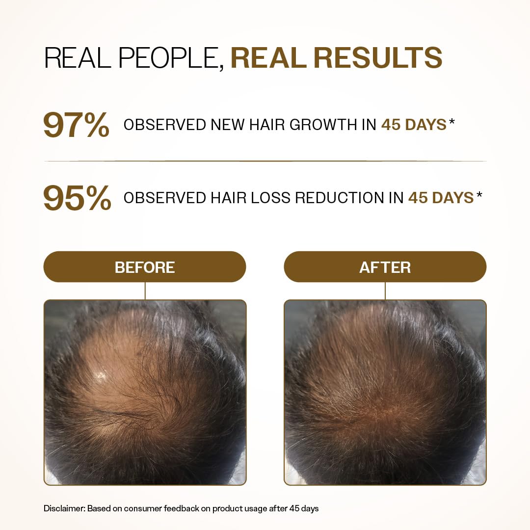 Bare Anatomy Advanced Hair Growth Serum| 3% Redensyl - 2x Better Results than Minoxidil | + 4% Anagain + 3% Baicapil | Rosemary, Biotin | Hair growth & Hair fall control serum for Women & Men | 30mL
