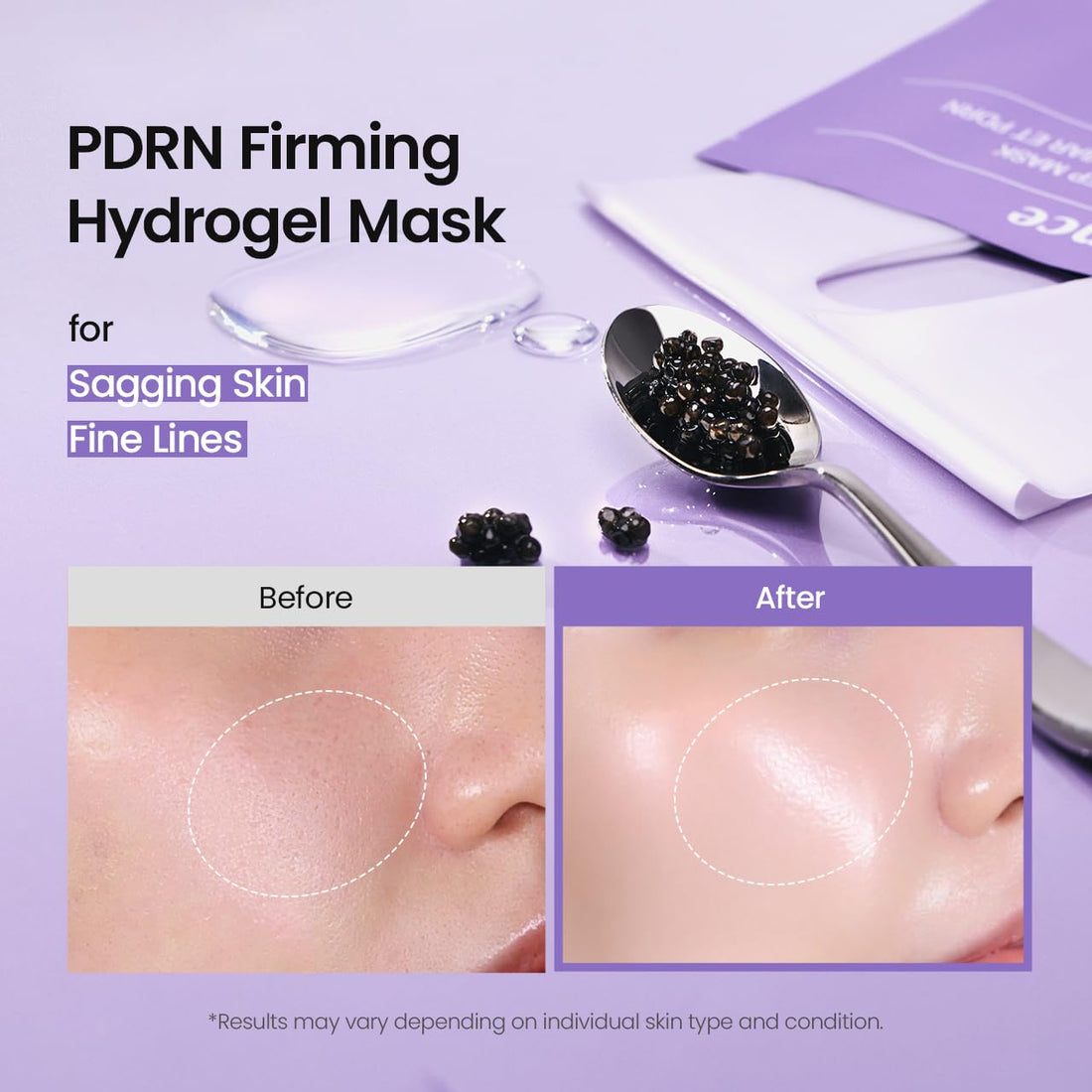 BIODANCE Hydro Cera-nol Real Deep Mask, Hydrating Overnight Hydrogel Face Mask, Moisturizing, Redness Reducing, Quick Soothing, After Sun Care, Sunburn Relief, Korean Skin Care |1.19oz(34g) x4ea Halalzen