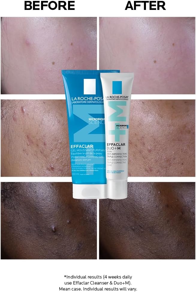 La Roche-Posay Effaclar Duo+M, Anti-Breakout Corrective Gel Moisturiser With Salicylic Acid & Niacinamide, Anti-Imperfections Triple Corrective Care, For Oily Blemish-Prone Skin, 40ml