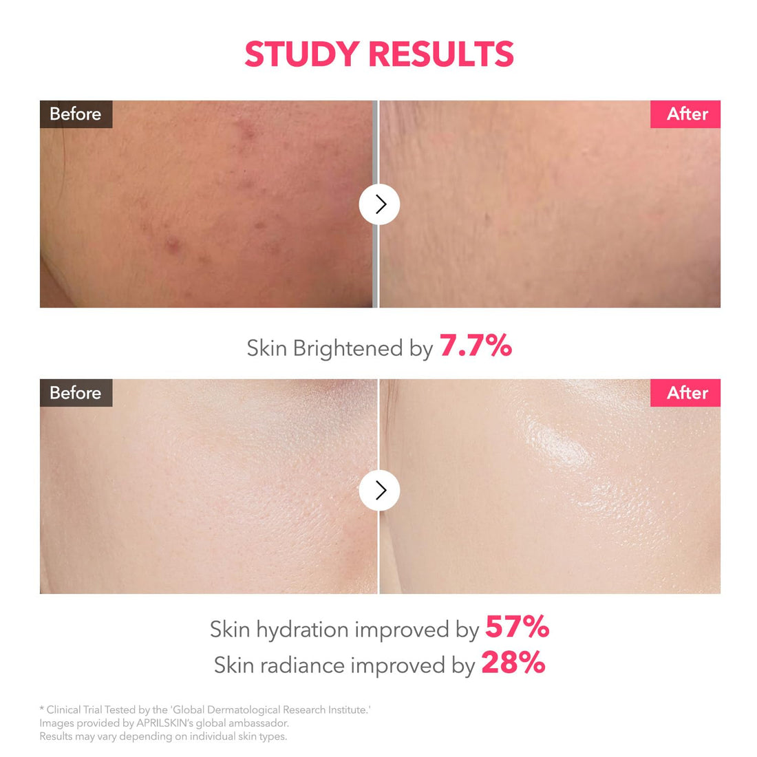 APRILSKIN TXA Pink Capsule Gel Mask | Overnight Face Mask for Glass Glow Skin I 99% High-Purity Tranexamic Acid 3 for uneven skin tone I Elasticity, Hydrating and Firming I Korean Skincare I 30g x 4ea Halalzen
