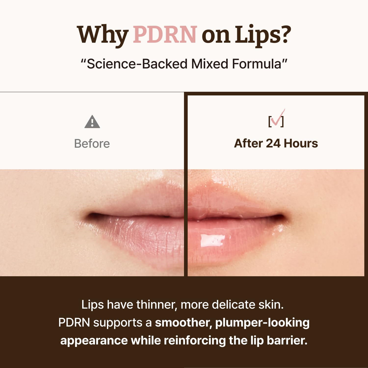 Dr.Reju-All Advanced PDRN Rejuvenating Lip Serum – Hydrating Lip Balm with Lipozip PDRN for Glowy, Dewy Lips – Gentle Exfoliating & Smoothing Lip Moisturizer – Hibiscus & Lactic Acid – 0.3 Fl Oz Halalzen