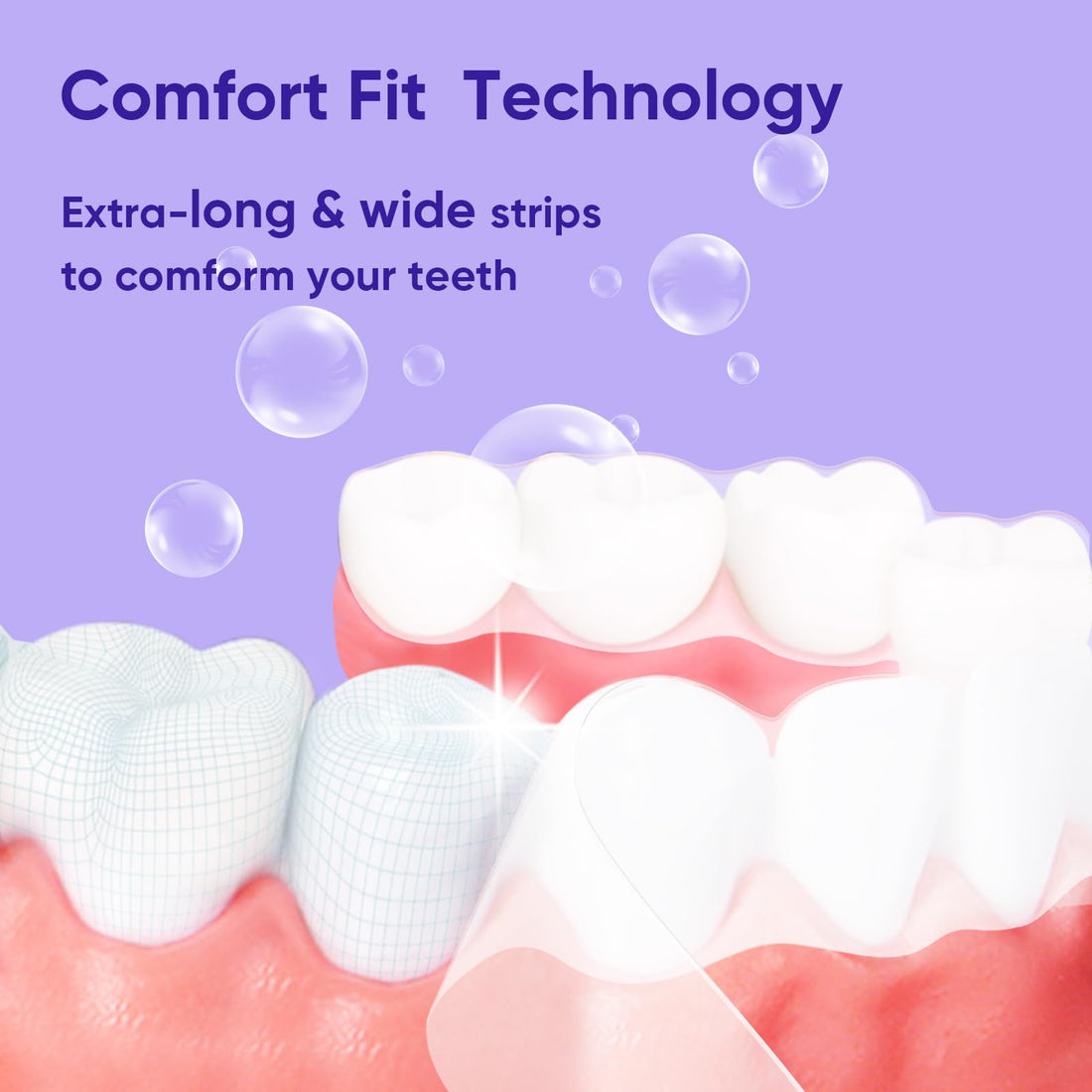 MySmile Teeth Whitening Kit, 28 Non-Sensitive Teeth Whitening Strips, Deluxe Teeth Whitener Dental Grade Tooth Whitening Strips for Home, Travel, 10 min Fast Result for Beautiful White Smile