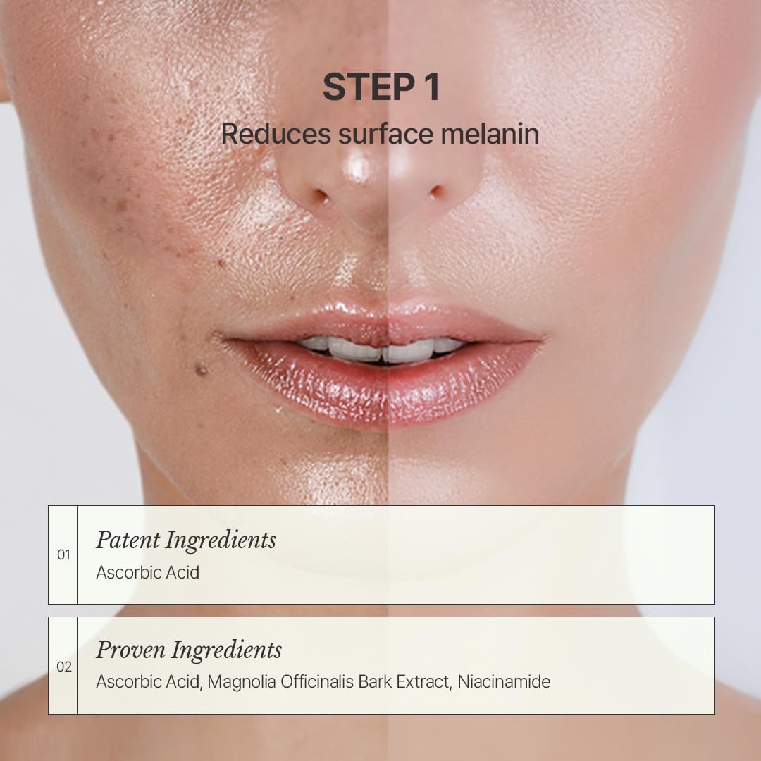 [CHALLANS de PARIS] Ampoule de Albarosa Dark Spot Care Serum – Sun Damage Repair, Brightening & Hydration, Face Ampoule for Even Skin Tone, Lightweight Korean Skincare, 35 ML
