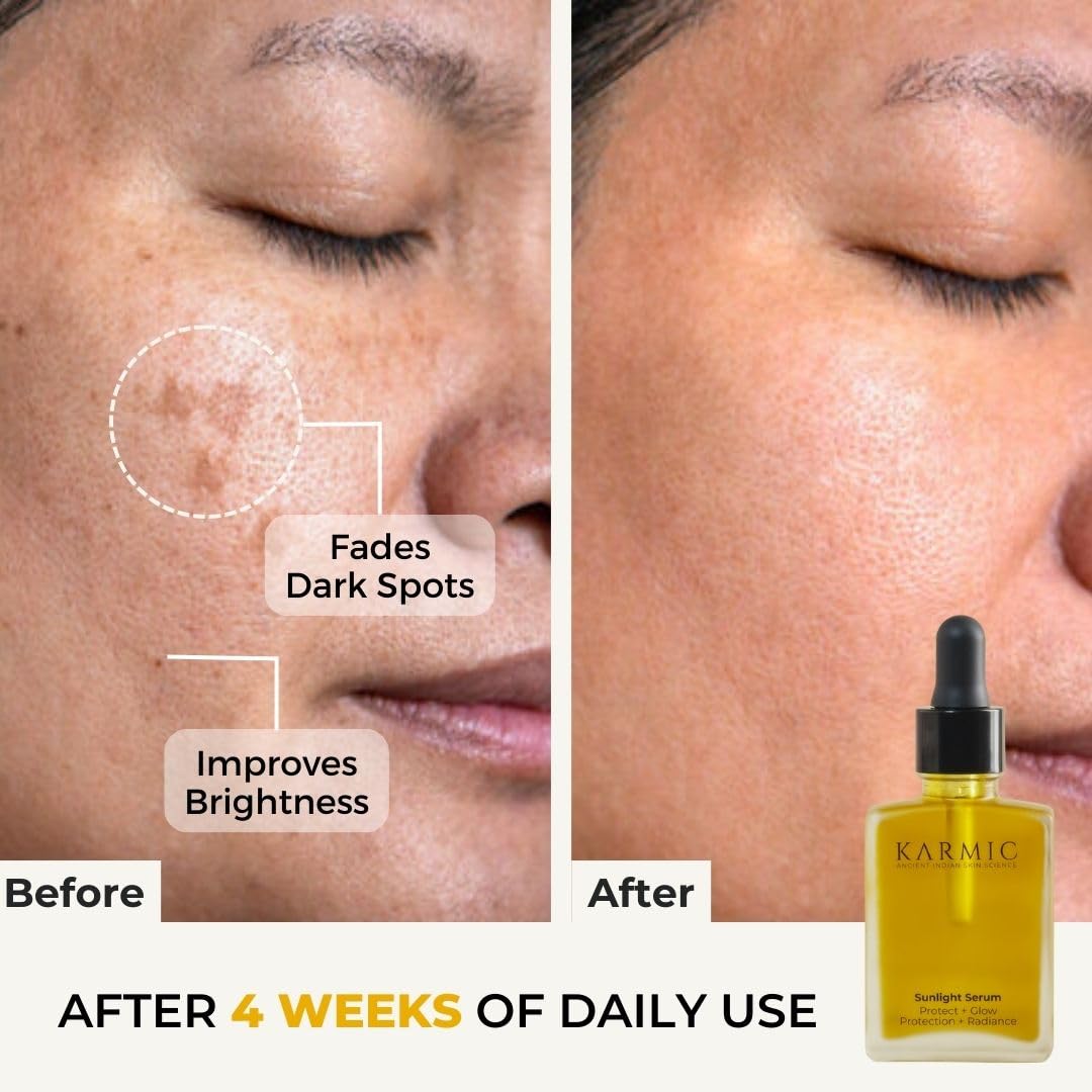 Karmic Skin Brightening Vitamin C Face Serum: With Saffron & Vit. E | Hydrate & Reveal Bright Glowing Skin | Correct Dark Spots | Treat Hyperpigmentation | Organic Facial Oil Skin Care | Women & Men