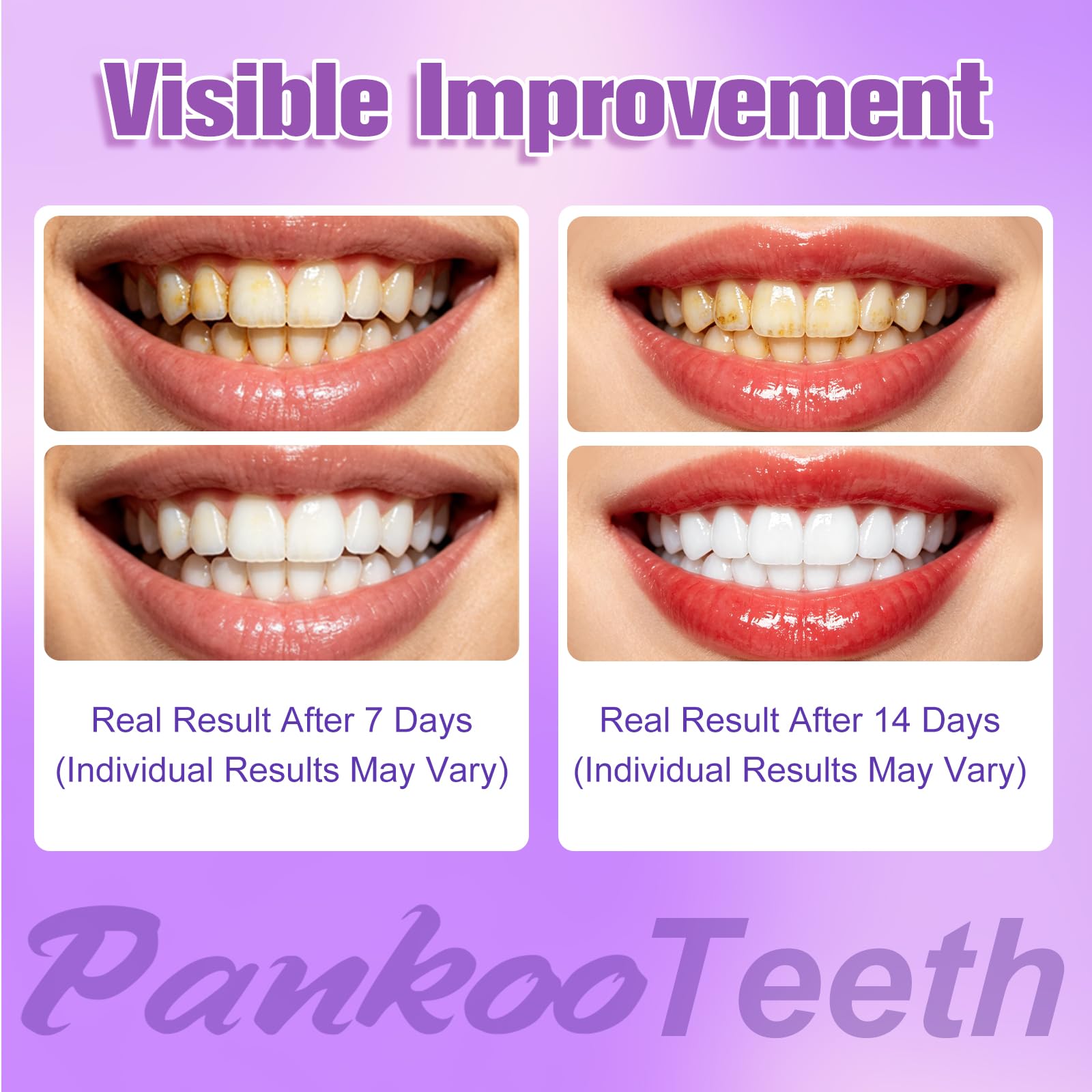 Purple Teeth Whitening Strips 14 Treatments, Helps Remove Surface Stains - Coffee & Wine Stains, Supports Enamel Care, No Sensitivity, No Slip, 28 Strips,Teeth Whitening Gel