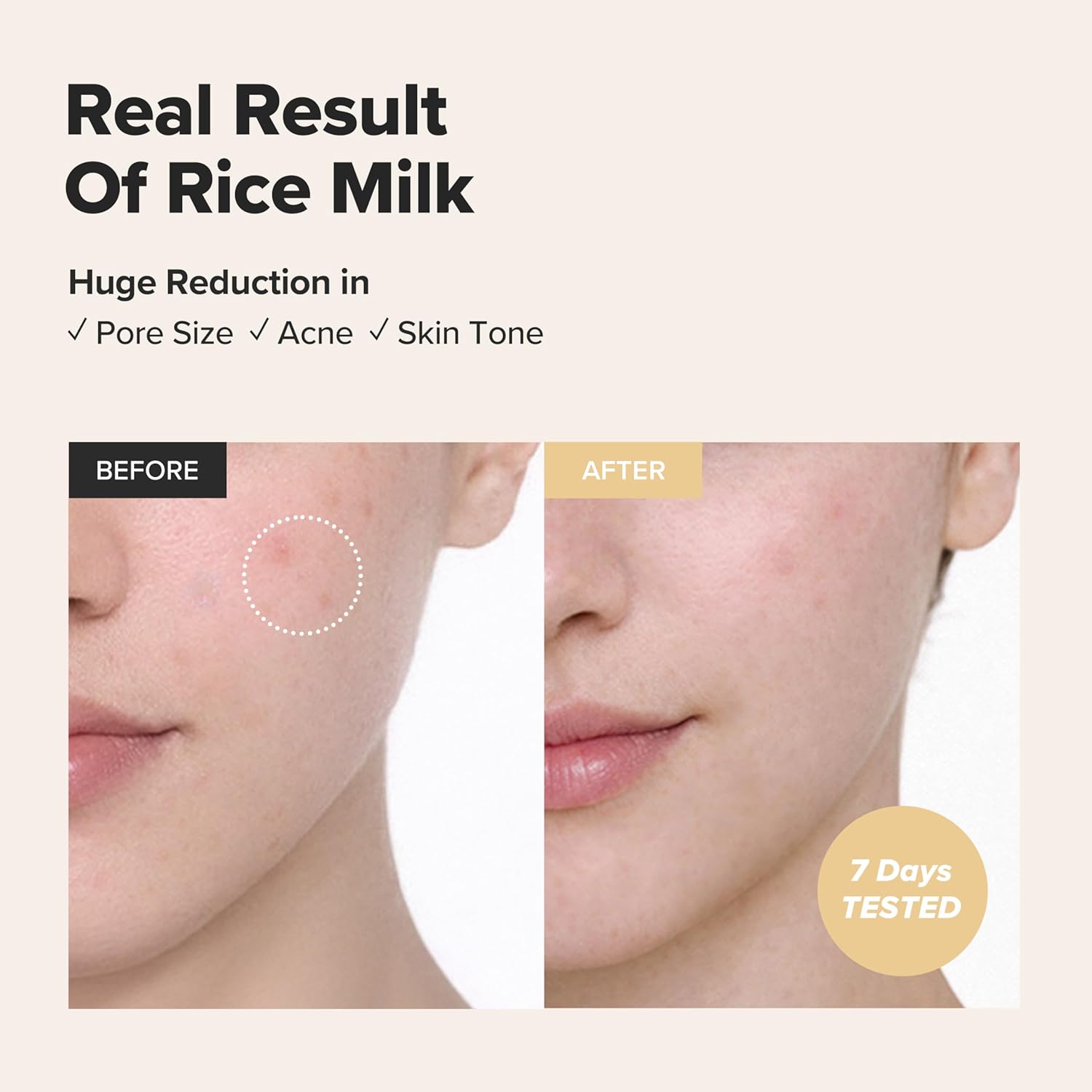 Beauty of Joseon Glow Replenishing Rice Milk Toner Deep Hydration and Oil Control with Rice Extract Hydrating Korean Milky Toner for All Skin Types, 150ml