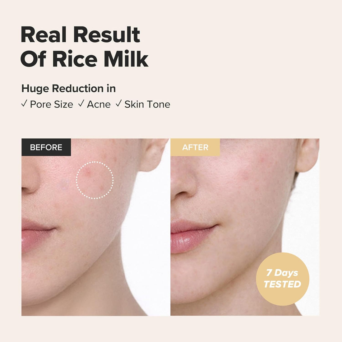 Beauty of Joseon Glow Replenishing Rice Milk Toner Deep Hydration and Oil Control with Rice Extract Hydrating Korean Milky Toner for All Skin Types, 150ml