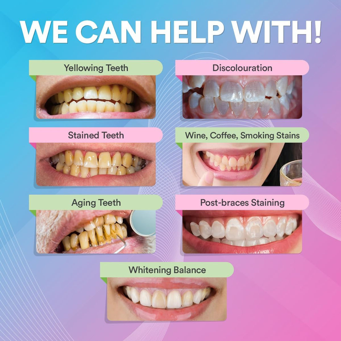 Smile Therapy Teeth Whitening Powder for Stain Removal, Enamel Safe, 6M Use | PAP+ technology, remove coffee tea wine stains, lifts dullness, gum safe, no abrasives, natural ingredients