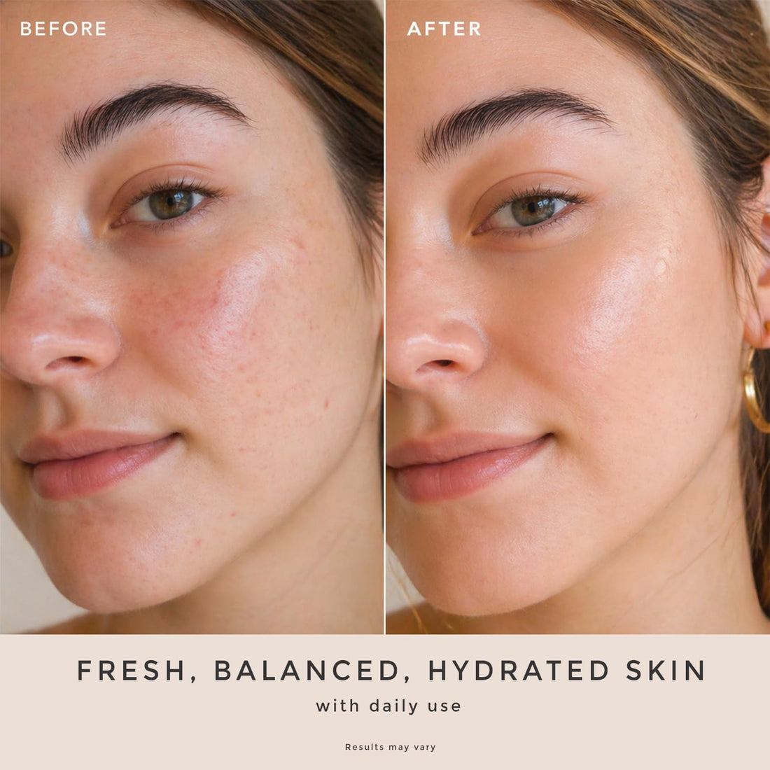 Spray d'eau de rose pour le visage - Fabriqué aux États-Unis avec des ingrédients naturels et biologiques hydratants pour une peau éclatante, tonique à l'eau de rose sans alcool avec hamamélis et glycérine pour peaux sèches et sensibles