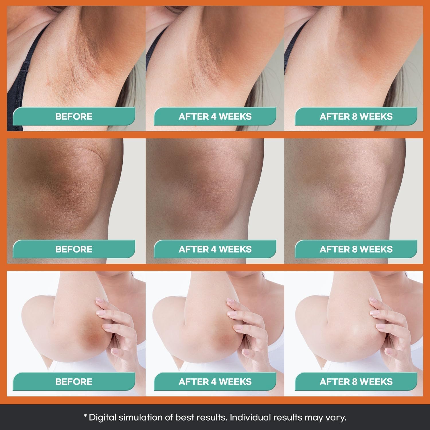 Natural Vine Dark Spot Corrector: Dark Spot Remover for Face Body in 4-8 Weeks - Instant Concealing & Age Brown Sun Faded Spot Remover Melasma Freckles Correcting with Niacinamide for Women & Men 60g Halalzen