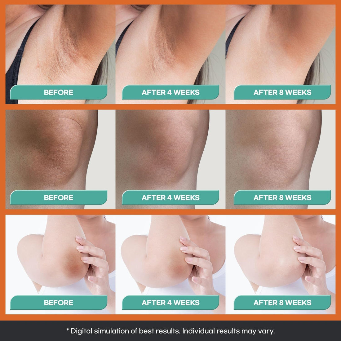 Natural Vine Dark Spot Corrector: Dark Spot Remover for Face Body in 4-8 Weeks - Instant Concealing & Age Brown Sun Faded Spot Remover Melasma Freckles Correcting with Niacinamide for Women & Men 60g Halalzen