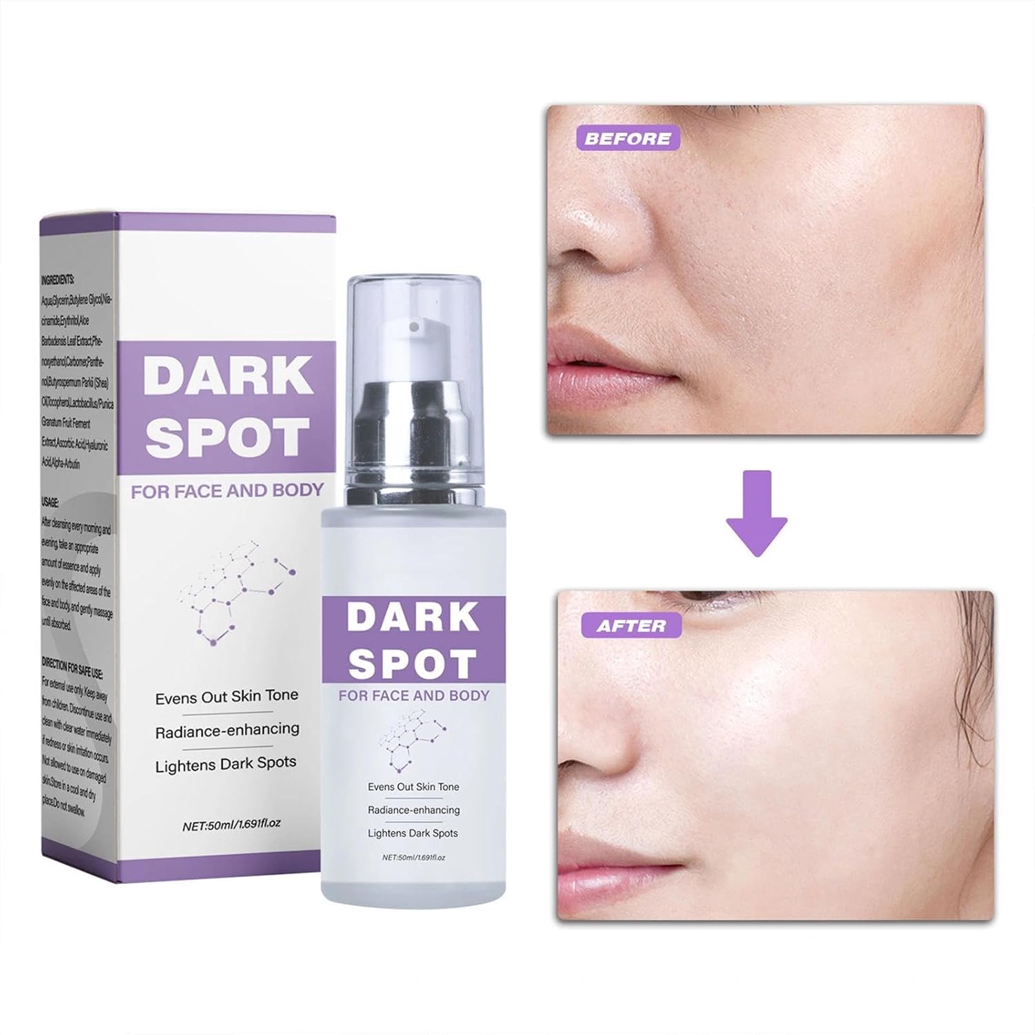Dark Spot Corrector Cream for Face & Body, Age Spot Remover with Niacinamide & Hyaluronic Acid, Brightening Melasma Cream for Sun Spots & Hyperpigmentation, Evens Skin Tone, 50ml Halalzen