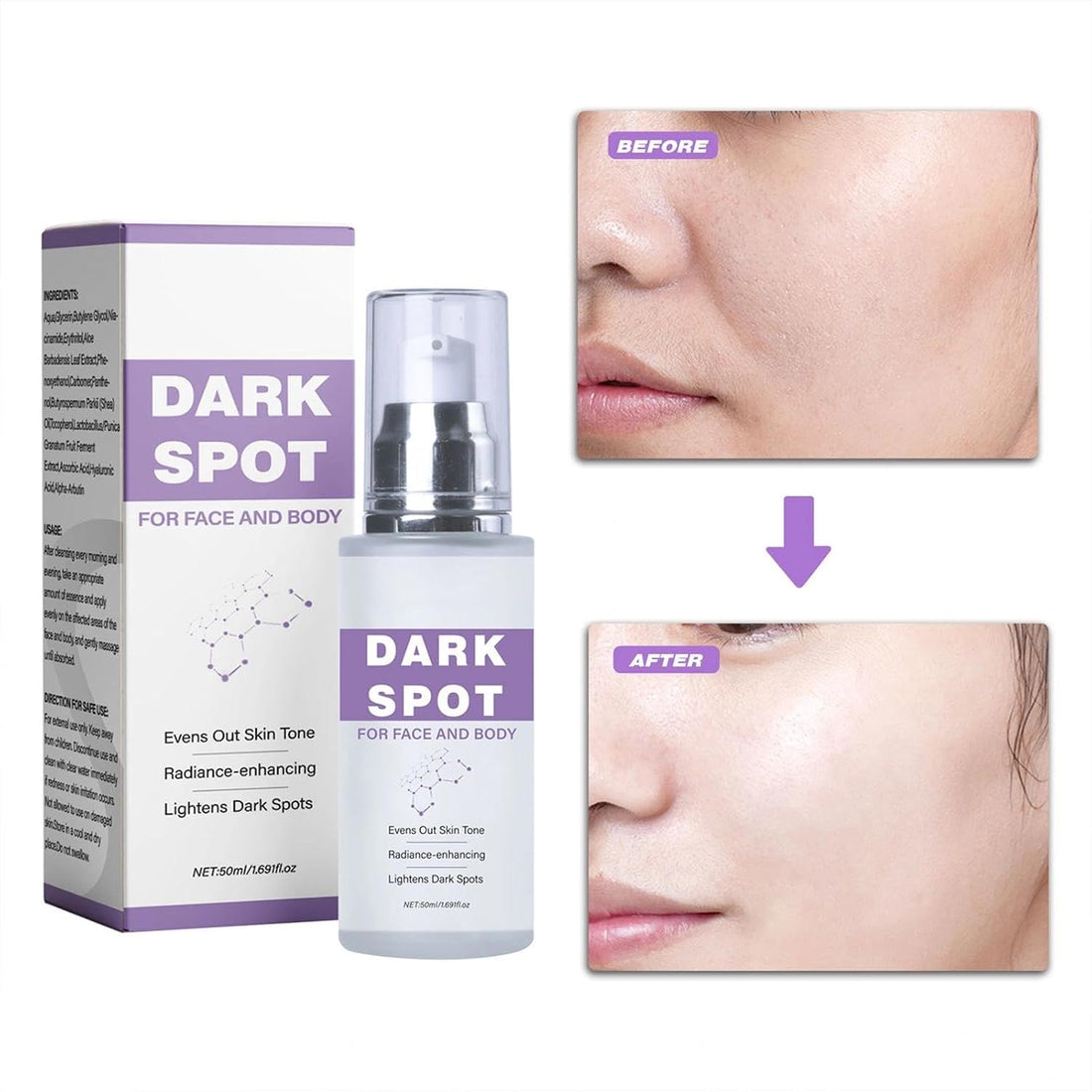 Dark Spot Corrector Cream for Face & Body, Age Spot Remover with Niacinamide & Hyaluronic Acid, Brightening Melasma Cream for Sun Spots & Hyperpigmentation, Evens Skin Tone, 50ml Halalzen