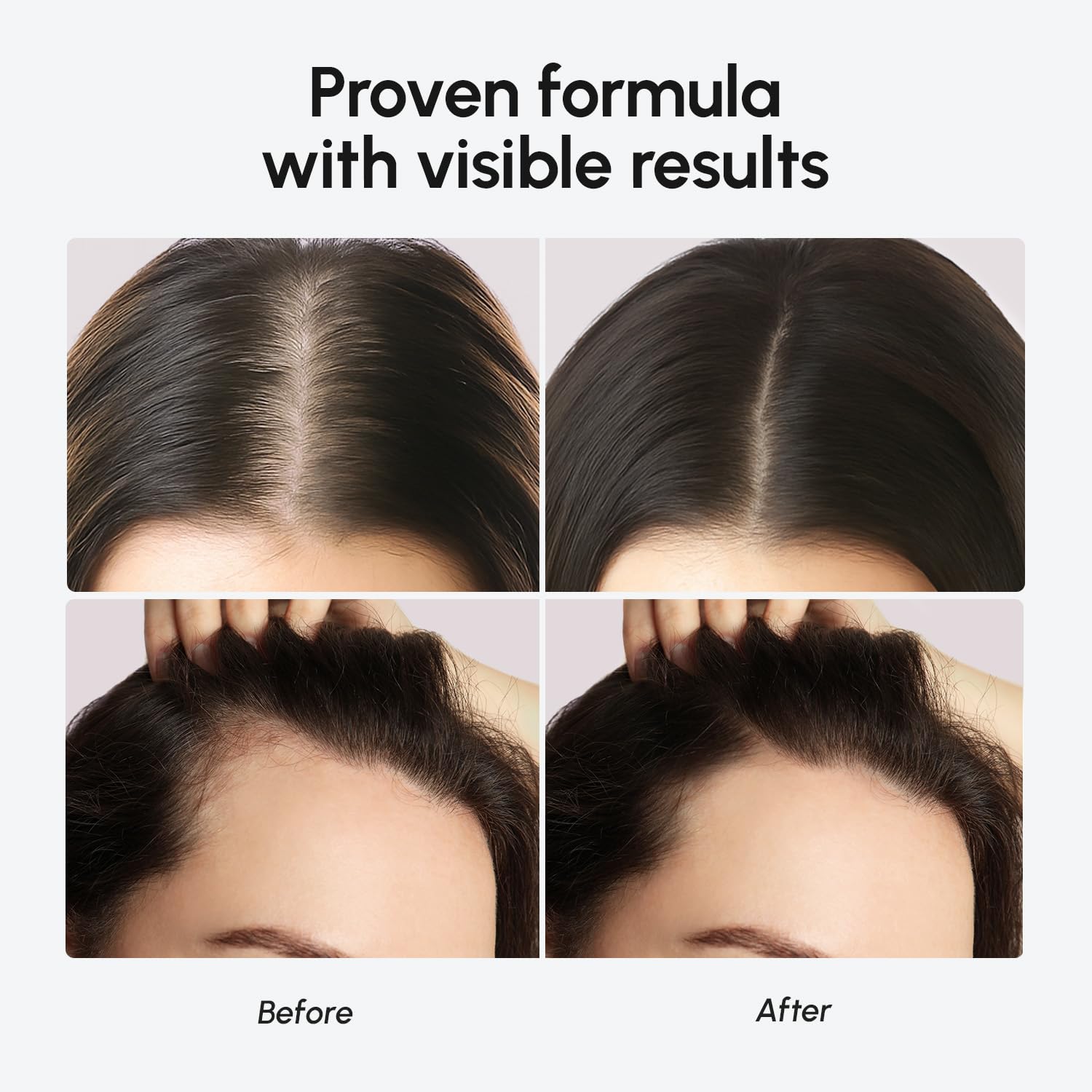 MAREE Haarwuchsserum - Koffeinpeptide Rizinus-Rosmarinöl für Haarwuchs - Produkte für Frauen & Männer - Haaröle für Haarwuchs - Haarwuchsmittel - Kopfhautserum - Suero Para El Cabello