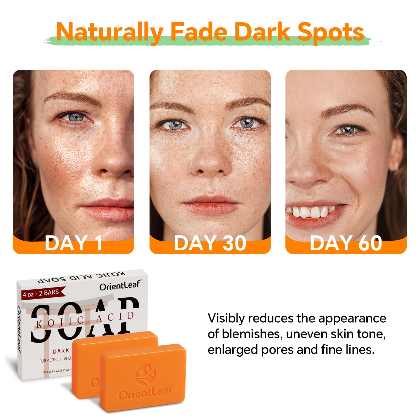 ORIENTLEAF Kojic Acid Soap, Turmeric Soap Bar for Dark Spots, Fresh Citrus Scent, Gentle for Face and Body with Vitamin C, Shea Butter, Retinol, Olive Oil, Collagen (3 PACK) Halalzen