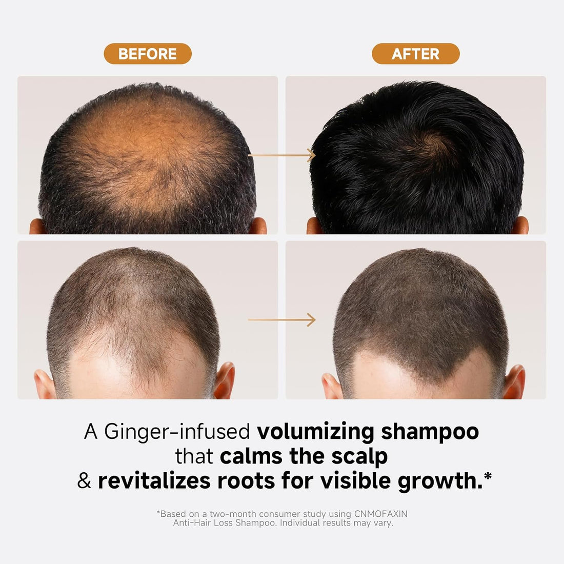 Anti Hair Loss Shampoo 480ml - Ginger Hair Growth & Castor Oil Strengthening Formula - Volumising Treatment with Rose Oil for Men & Women - Nourishes, Repairs & Thickens