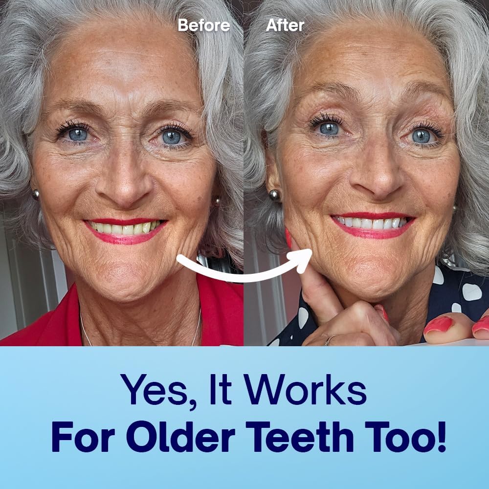 MySweetSmile Teeth Whitening Powder – 6 Month Supply – Removes Years of Coffee, Tea, Smoking & Ageing Stains – Dentist-Approved & Enamel-Safe – IndyBest Award-Winning Whitener – Fresh Mint Flavour