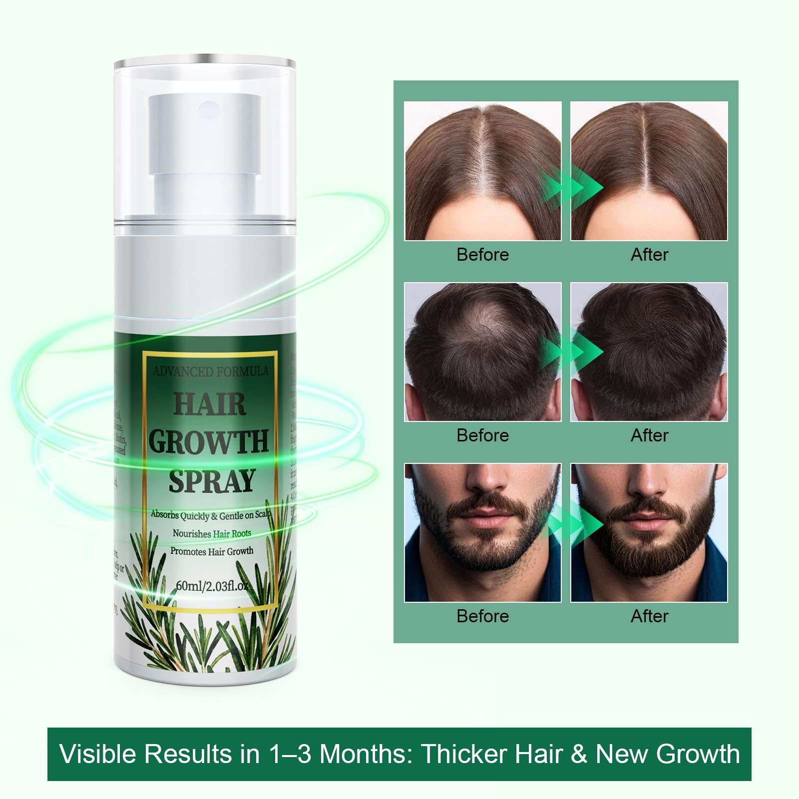 Hair Growth Serum with Rosemary Oil & Batana Oil for Women & Men 60ml | Support for Hair Loss | Strengthening Care for Thinning Hair | Supports Hair Growth | Fast Absorbing | Hair & Beard Care