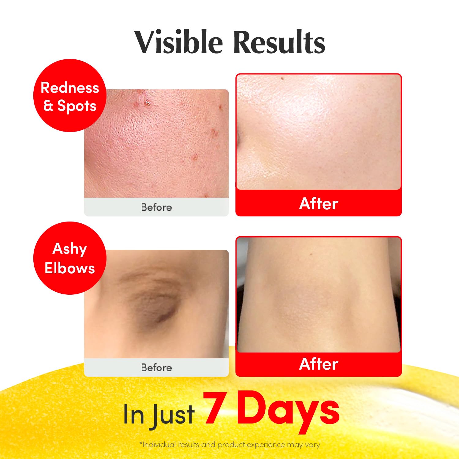 EQQUALBERRY Vitamin Illuminating Serum | Niacinamide 4% + Brightening Vitamin C Face Serum with Hyaluronic Acid & Vitamin E | Dark Spot, Uneven Tone Care | Korean Skincare, 1.01 fl.oz Halalzen